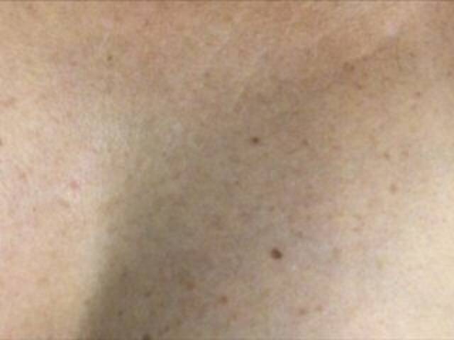 Uitzending screenshots Alianakiss