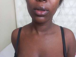 Erotische videochat Freakynessa